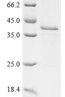 (Tris-Glycine gel) Discontinuous SDS-PAGE (reduced) with 5% enrichment gel and 15% separation gel.