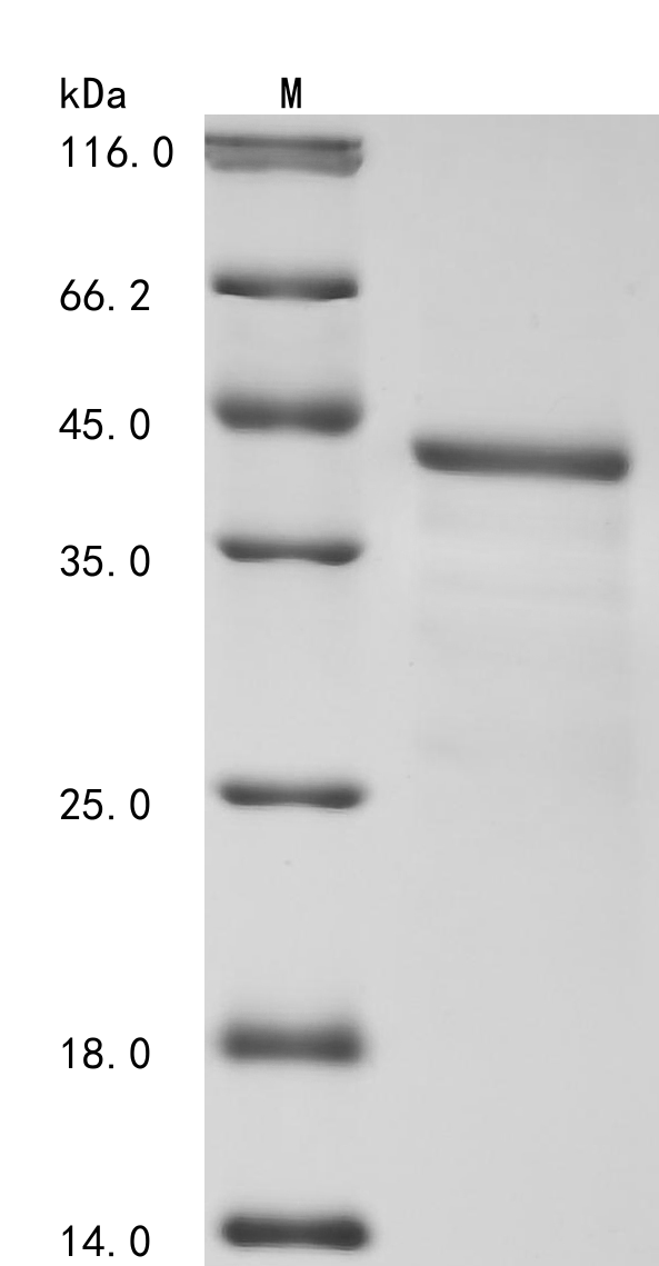 Recombinant Human Biotinidase (BTD), partial