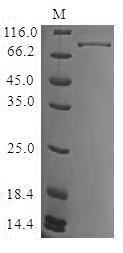 Recombinant Human Tyrosine-protein kinase BTK (BTK), Homo sapiens (Human), Baculovirus, N-terminal 10xHis-tagged, 78.3kDa, purity >90% as determined by SDS-PAGE.