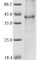 (Tris-Glycine gel) Discontinuous SDS-PAGE (reduced) with 5% enrichment gel and 15% separation gel.