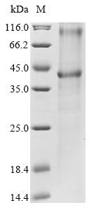 Recombinant Human Ceramide glucosyltransferase (UGCG) Protein, Homo sapiens (Human), in vitro E.coli expression system, N-terminal 10xHis-tagged, 47.7kDa, purity >85% as determined by SDS-PAGE.