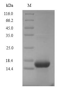 Recombinant Human Complement C5 (C5), partial, Homo sapiens (Human), Mammalian cell, N-terminal 6xHis-Myc-tagged, 12.3kDa, purity >90% as determined by SDS-PAGE.