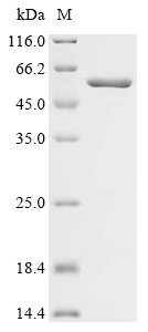 Recombinant Human C5a anaphylatoxin chemotactic receptor (C5AR1), partial, Biotinylated, Homo sapiens (Human), E.coli, N-terminal MBP-tagged and C-terminal 6xHis-Avi-tagged, 52.1kDa, purity >90% as determined by SDS-PAGE.