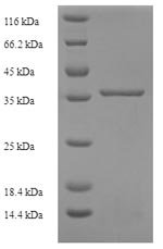 Recombinant Human Complement component C8 gamma chain (C8G), Homo sapiens (Human), E.coli, N-terminal 6xHis-SUMO-tagged, 36.4kDa, purity >90% as determined by SDS-PAGE.