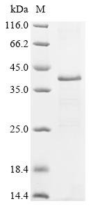 Recombinant Hepatitis B virus genotype A2 subtype adw2 Large envelope protein (S) Protein, Hepatitis B virus genotype A2 subtype adw2 (isolate Germany/991/1990) (HBV-A), in vitro E.coli expression system, N-terminal 10xHis-tagged, 45.1kDa, purity >85% as determined by SDS-PAGE.