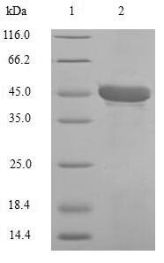 Recombinant Human Carbonic anhydrase 1 (CA1)