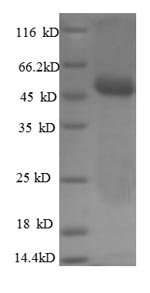 Recombinant Human Carbonic anhydrase 12 (CA12), partial