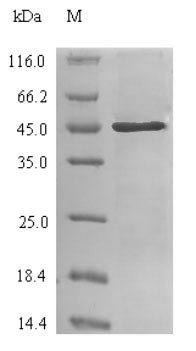 Recombinant Human Carbonic anhydrase 2 (CA2), Homo sapiens (Human), E.coli, N-terminal 6xHis-SUMO-tagged, 45.1kDa, purity >90% as determined by SDS-PAGE.