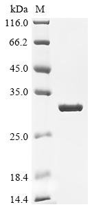 Recombinant Human Carbonic anhydrase 2 (CA2) (Active), Homo sapiens (Human), Mammalian cell, C-terminal 10xHis-tagged, 30.7kDa, purity >95% as determined by SDS-PAGE.