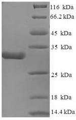 Recombinant Human Voltage-dependent calcium channel subunit alpha-2/delta-1 (CACNA2D1), partial, Homo sapiens (Human), E.coli, N-terminal 6xHis-SUMO-tagged, 32.3kDa, purity >85% as determined by SDS-PAGE.