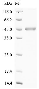 Recombinant Human CAD protein (CAD), partial