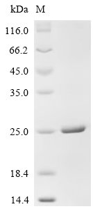 Recombinant Human Calcitonin gene-related peptide 1 (CALCA), partial, Homo sapiens (Human), E.coli, N-terminal 6xHis-GST-tagged, 35.3kDa, purity >90% as determined by SDS-PAGE.