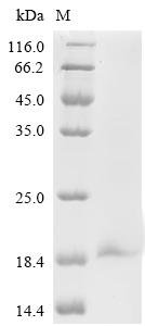 Recombinant Influenza A virus Matrix protein 2 (M) Protein, Influenza A virus (strain A/Chile/1/1983 H1N1), in vitro E.coli expression system, C-terminal 6xHis-tagged, 12.1kDa, purity >95% as determined by SDS-PAGE.