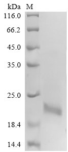 Recombinant Human Calcitonin gene-related peptide 1 (CALCA), partial, Homo sapiens (Human), Yeast, N-terminal 6xHis-sumostar-tagged, 16.6kDa, purity >90% as determined by SDS-PAGE.