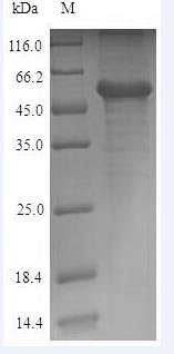 Recombinant Human Calreticulin (CALR)