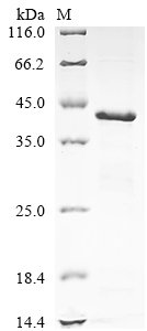 Recombinant Human Calreticulin (CALR), partial