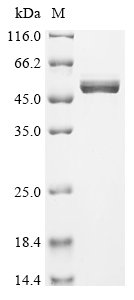 Recombinant Human Calreticulin (CALR)