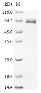 Recombinant Human Calcium/calmodulin-dependent protein kinase type II subunit delta (CAMK2D)