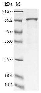 Recombinant Human Calcium/calmodulin-dependent protein kinase type II subunit delta (CAMK2D), Homo sapiens (Human), E.coli, C-terminal 6xHis-tagged, 63.1kDa, purity >85% as determined by SDS-PAGE.