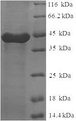 Recombinant Human Calpain small subunit 1 (CAPNS1)