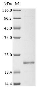 Recombinant Human Caspase recruitment domain-containing protein 17 (CARD17), Homo sapiens (Human), E.coli, N-terminal 10xHis-tagged and C-terminal Myc-tagged, 19.3kDa, purity >90% as determined by SDS-PAGE.
