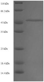Recombinant Human CAS1 domain-containing protein 1 (CASD1), partial