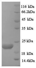 Recombinant Human Caspase-8 (CASP8), partial