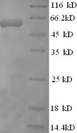Recombinant Human Cystathionine beta-synthase (CBS), partial, Homo sapiens (Human), E.coli, N-terminal 6xHis-tagged, 64.5kDa, purity >90% as determined by SDS-PAGE.
