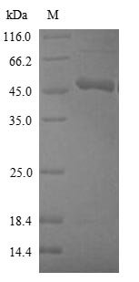 Recombinant Human Cystathionine beta-synthase (CBS), partial