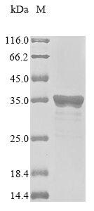 Recombinant Human Chromobox protein homolog 5 (CBX5)