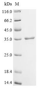 Recombinant Human Cell division cycle and apoptosis regulator protein 1 (CCAR1), partial, Homo sapiens (Human), E.coli, N-terminal 10xHis-tagged and C-terminal Myc-tagged, 34.3kDa, purity >95% as determined by SDS-PAGE.