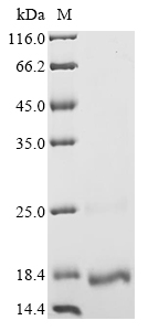 Recombinant Human Girdin (CCDC88A), partial