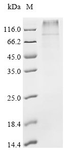 Recombinant Pig Potassium voltage-gated channel subfamily KQT member 1 (KCNQ1) Protein, Sus scrofa (Pig), in vitro E.coli expression system, N-terminal 10xHis-tagged, 75.5kDa, purity >85% as determined by SDS-PAGE.