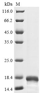 Recombinant Human C-C motif chemokine 2 (CCL2)