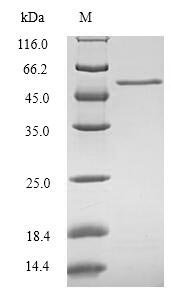 Recombinant Human CCN family member 1 (CCN1), Homo sapiens (Human), E.coli, N-terminal 6xHis-SUMO-tagged, 55.4kDa, purity >90% as determined by SDS-PAGE.