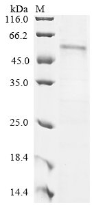 Recombinant Human G2/mitotic-specific cyclin-B1 (CCNB1)