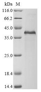 Recombinant Human Scavenger receptor cysteine-rich type 1 protein M130 (CD163), partial, Homo sapiens (Human), E.coli, N-terminal 10xHis-tagged and C-terminal Myc-tagged, 41.7kDa, purity >85% as determined by SDS-PAGE.