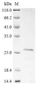 Recombinant Human SLP adapter and CSK-interacting membrane protein (SCIMP) Protein, Homo sapiens (Human), in vitro E.coli expression system, N-terminal 10xHis-tagged, 22.7kDa, purity >85% as determined by SDS-PAGE.