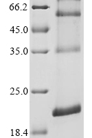 (Tris-Glycine gel) Discontinuous SDS-PAGE (reduced) with 5% enrichment gel and 15% separation gel.