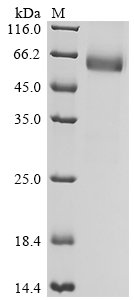 Recombinant Human Leukocyte surface antigen CD47 (CD47), partial, Biotinylated, Homo sapiens (Human), Mammalian cell, C-terminal hFc1-Avi-tagged, 43.3kDa, purity >90% as determined by SDS-PAGE.