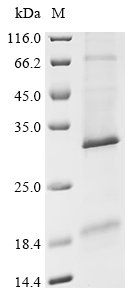 (Tris-Glycine gel) Discontinuous SDS-PAGE (reduced) with 5% enrichment gel and 15% separation gel.