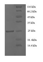 Recombinant Human CD81 antigen (CD81), partial, Homo sapiens (Human), E.coli, N-terminal 6xHis-SUMO-tagged, 25.8kDa, purity >90% as determined by SDS-PAGE.