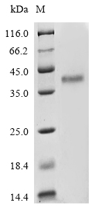 Recombinant Human CD81 antigen (CD81), partial, Homo sapiens (Human), Mammalian cell, C-terminal hFc1-tagged, 38.7kDa, purity >85% as determined by SDS-PAGE.