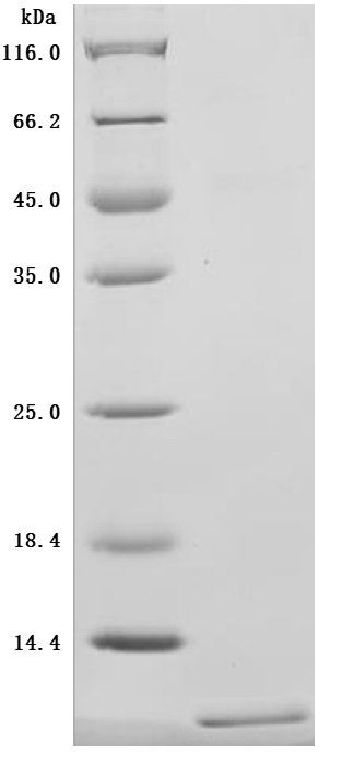 Recombinant Human CD81 antigen (CD81), partial (Active), Homo sapiens (Human), Mammalian cell, C-terminal 10xHis-tagged, 11.1kDa, purity >95% as determined by SDS-PAGE.