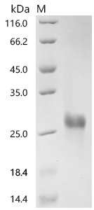 Recombinant Human T-cell surface glycoprotein CD8 alpha chain (CD8A), partial (Active)