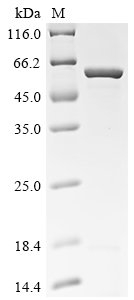 Recombinant Human CD9 antigen (CD9), partial, Biotinylated, Homo sapiens (Human), E.coli, N-terminal MBP-tagged and C-terminal 6xHis-Avi-tagged, 57.6kDa, purity >85% as determined by SDS-PAGE.