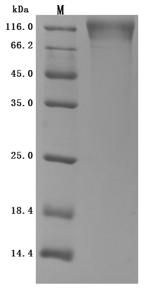Recombinant Human T-cell surface protein tactile (CD96), partial (Active)