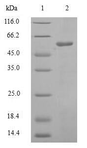 Recombinant Human M-phase inducer phosphatase 3 (CDC25C)