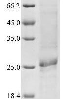(Tris-Glycine gel) Discontinuous SDS-PAGE (reduced) with 5% enrichment gel and 15% separation gel.