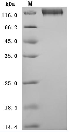 Recombinant Human Carcinoembryonic antigen-related cell adhesion molecule 5 (CEACAM5) (E398K) (Active)